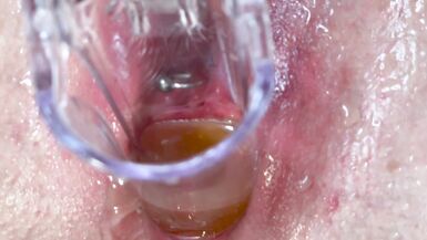 He pee into my pussy by speculum and I squirt too - 12 image