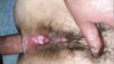Vegetables in the ass close up. Hairy Anal. Gaping Asshole. - 15 image