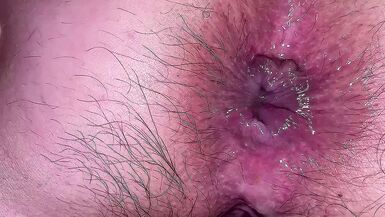 LOOK UP MY ASS. ANAL FUCKING, SPERM GETS OUT OF ANUS - 1 image