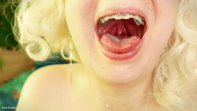 giro della bocca con lapparecchio - vore fetish - primo piano - 1 image