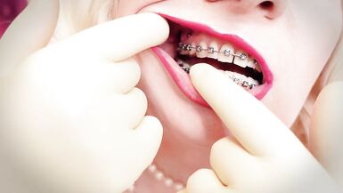 ASMR episode: mother I'd like to fuck wearing double layer medical gloves and showing braces. 4k movie scene fetish sounding. Arya Grander - 13 image