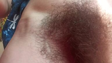 OMG hairy parasite, farts and queefs - 1 image