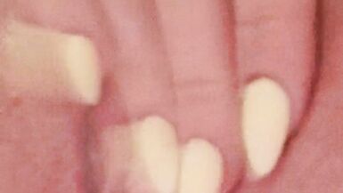 Up close of my BIG HOLE