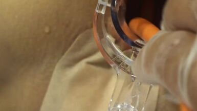 Elmers Wife Anal fisting speculum trois - 1 image