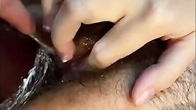 Dirty Slut Wife Anal. Development Hairy Ass Hole. Fisting & Double Penetration. - 4 image